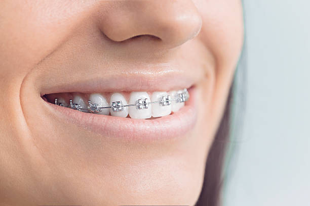 Best Veneers and Lumineers  in Cache, OK
